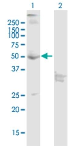 Anti-CNR1 antibody produced in mouse