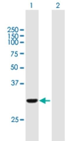 Anti-COASY antibody produced in mouse