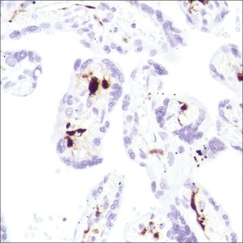 Anti-Coagulation Factor XIII A, Rabbit monoclonal