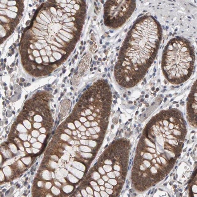 Anti-COASY antibody produced in rabbit