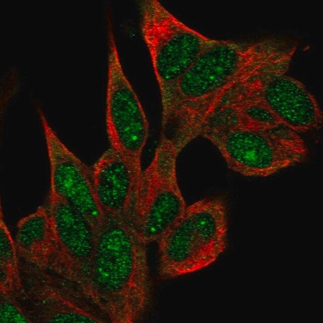 Anti-COIL antibody produced in rabbit