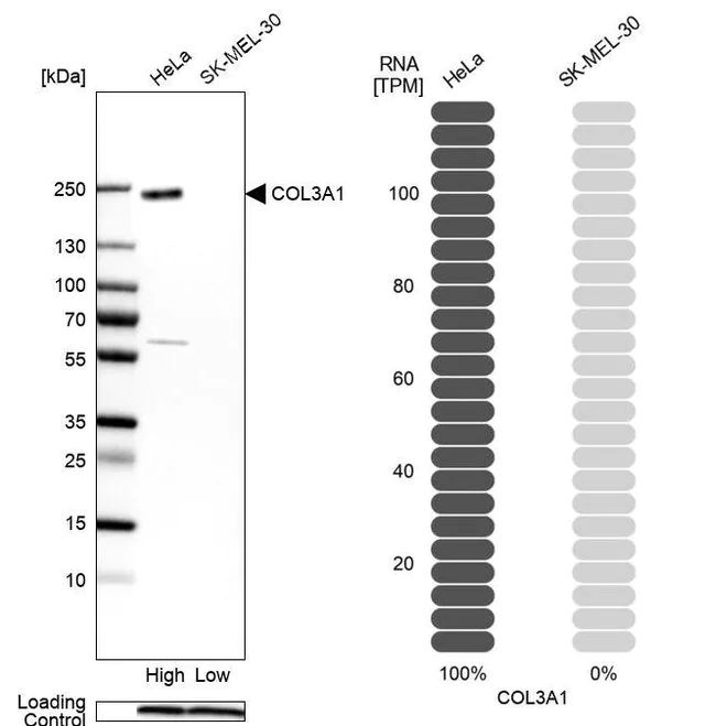 Anti-COL3A1 antibody produced in rabbit