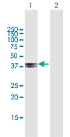 Anti-COL9A1 antibody produced in mouse