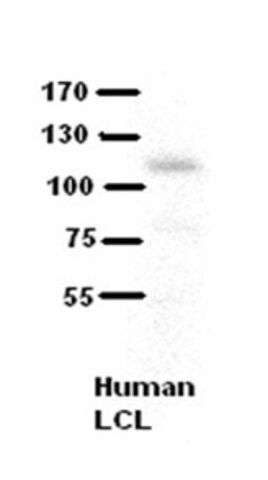 Anti-COL6A1 antibody produced in rabbit