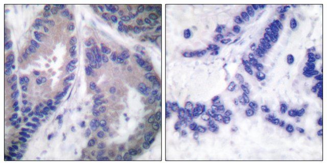 Anti-Collagen 1 XVIII, C-Terminal antibody produced in rabbit