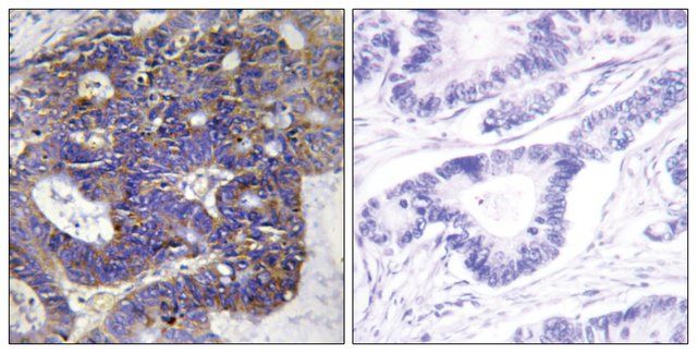 Anti-Collagen IV 2 antibody produced in rabbit