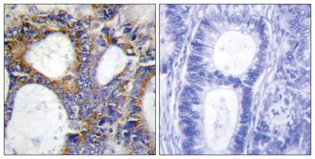 Anti-Collagen I 2 antibody produced in rabbit