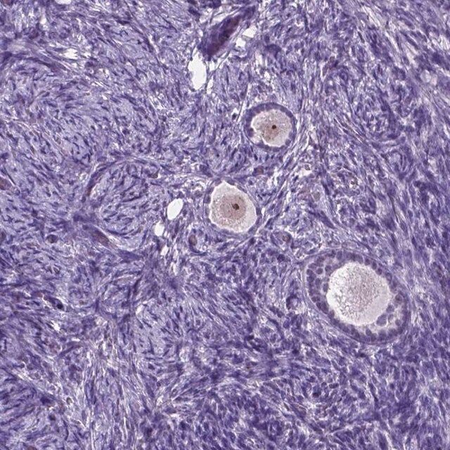 Anti-C18orf21 antibody produced in rabbit