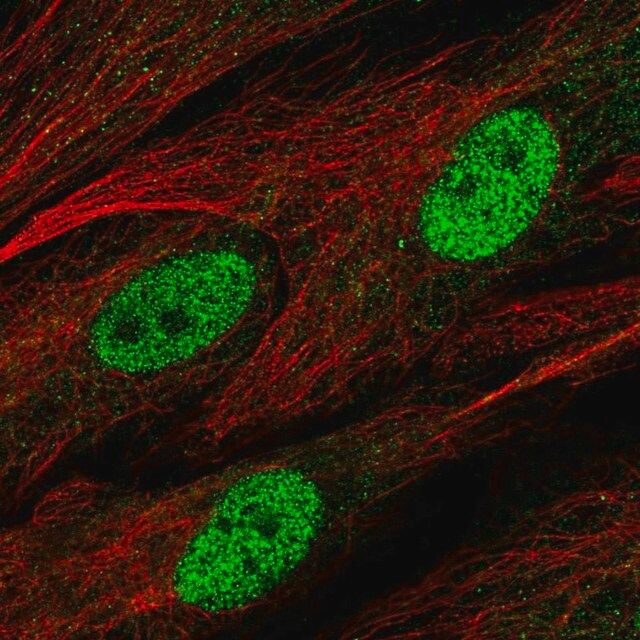 Anti-C1orf204 antibody produced in rabbit