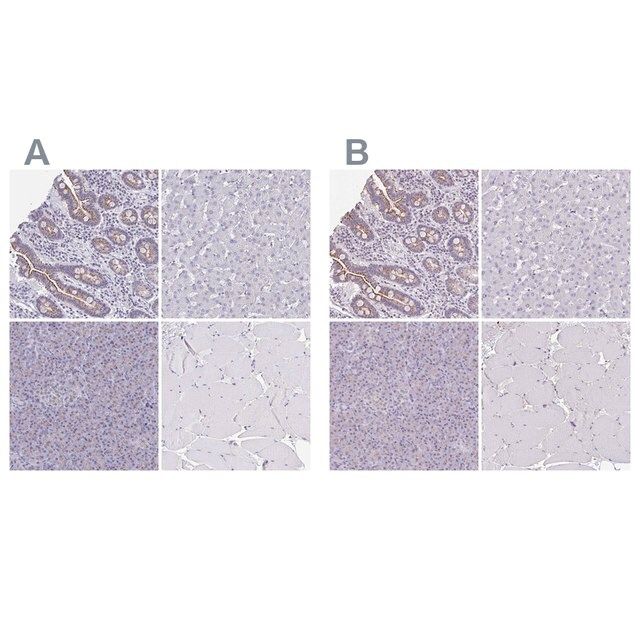 Anti-CHMP5 antibody produced in rabbit