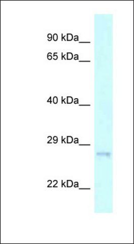 Anti-CHMP2A antibody produced in rabbit