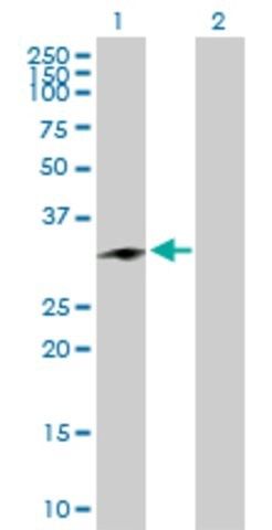 Anti-CHMP1A antibody produced in rabbit