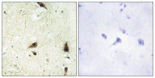 Anti-CHRC1 antibody produced in rabbit