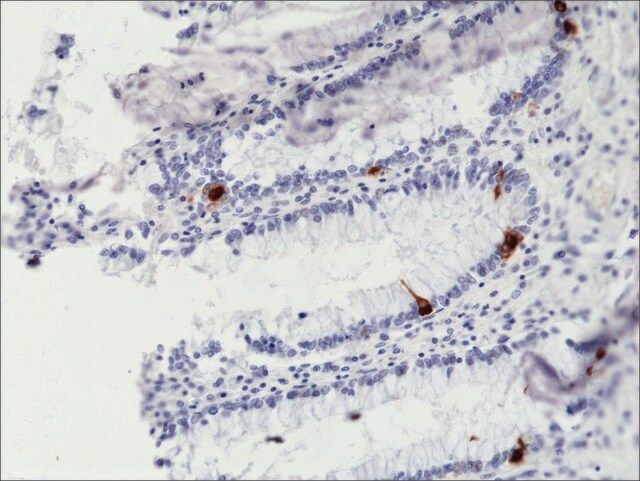 Anti-Chromogranin A antibody, Rabbit monoclonal