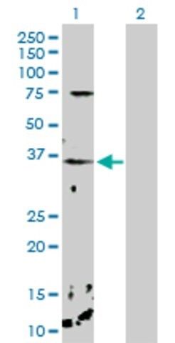 Anti-CHP antibody produced in rabbit