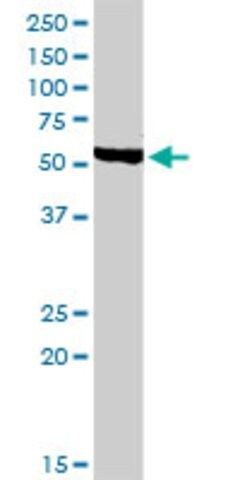 Anti-CHRDL1 antibody produced in rabbit