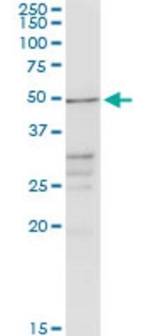 Anti-CHRDL2 antibody produced in rabbit