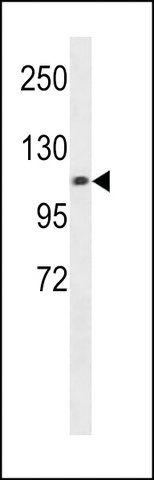 ANTI-CHSY3 (CENTER) antibody produced in rabbit