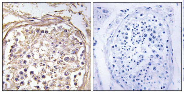 Anti-CHST9, C-Terminal antibody produced in rabbit