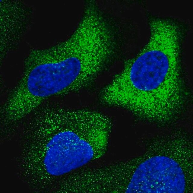 Anti-CHST10 antibody produced in rabbit