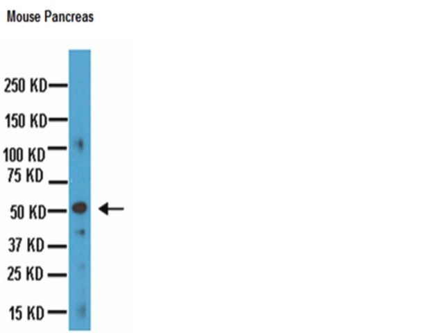 Anti-Chromogranin A Antibody, clone LK2H10