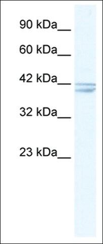 Anti-CHRNA7