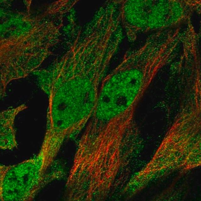 Anti-CHRND antibody produced in rabbit