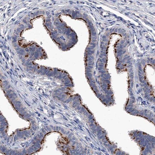 Anti-CHRNA3 antibody produced in rabbit