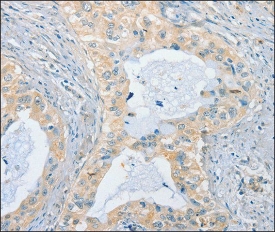 Anti-CHRNA2 antibody produced in rabbit