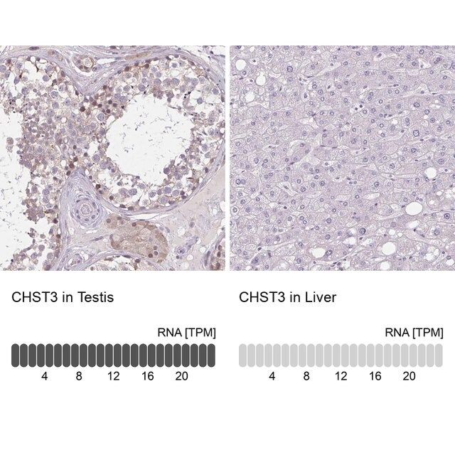 Anti-CHST3 antibody produced in rabbit