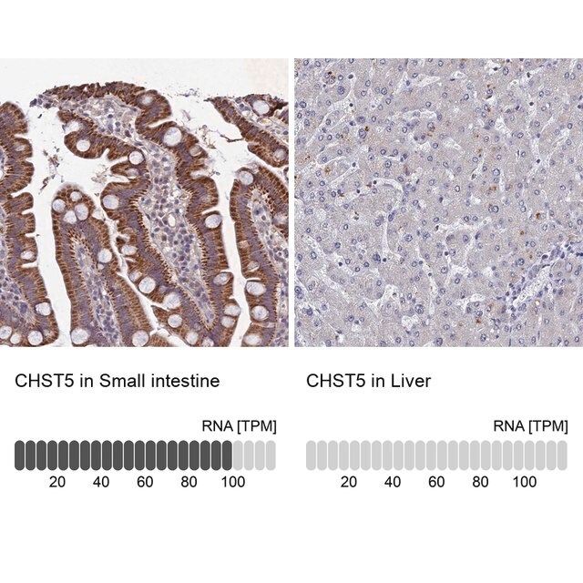 Anti-CHST5 antibody produced in rabbit