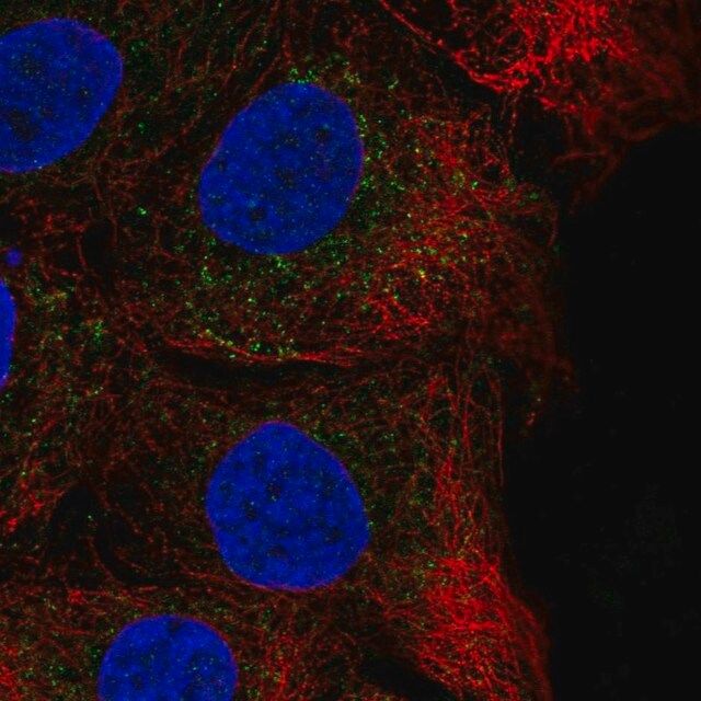 Anti-CHST14 antibody produced in rabbit