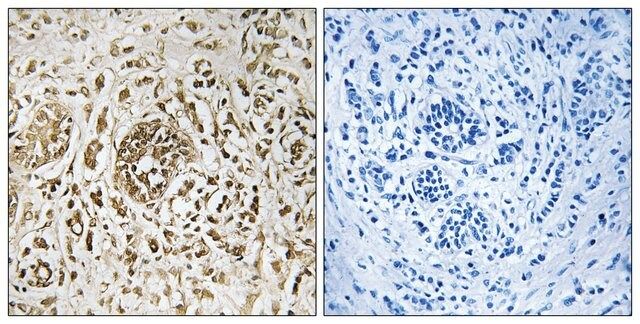 Anti-CIB2 antibody produced in rabbit