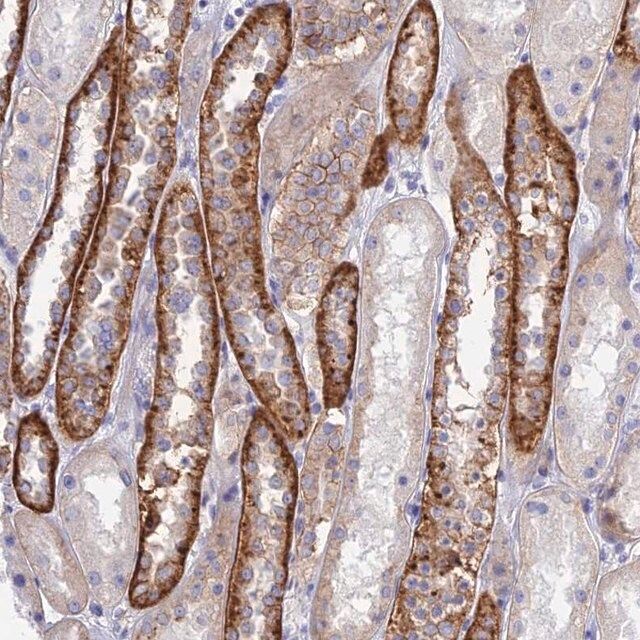 Anti-CHSY3 antibody produced in rabbit