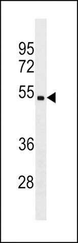 ANTI-CHST5(C-TERMINAL) antibody produced in rabbit