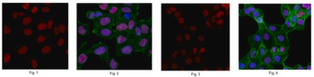 Anti-Chromobox protein homolog 5 Antibody