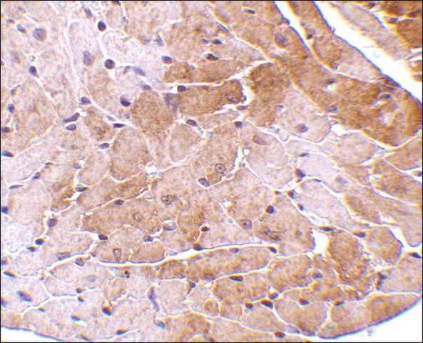 Anti-CIDE-A (ab1) antibody produced in rabbit