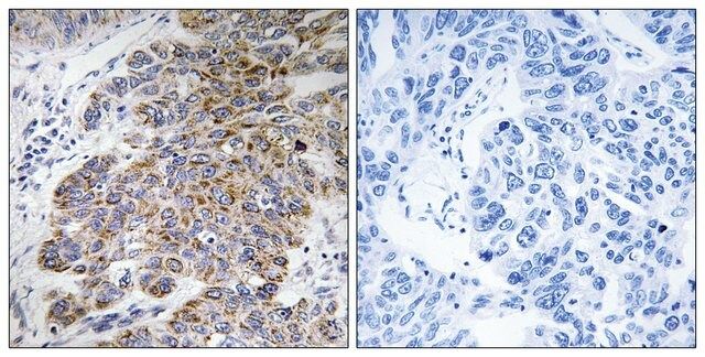 Anti-CHST10 antibody produced in rabbit