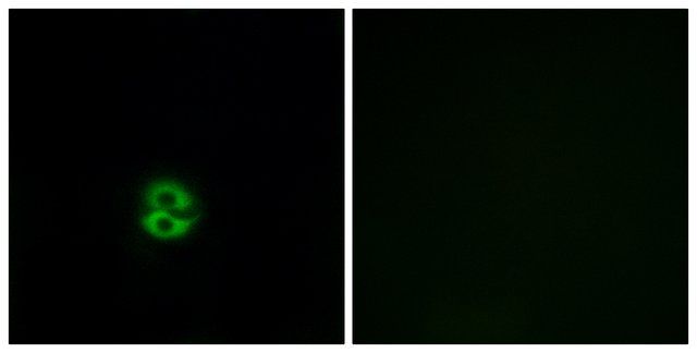 Anti-CHST6 antibody produced in rabbit