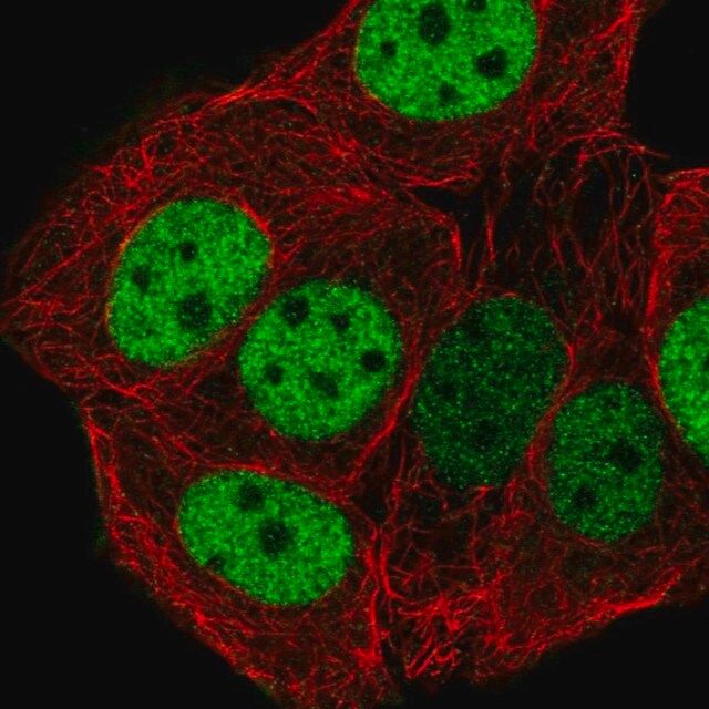 Anti-CHTF18 antibody produced in rabbit