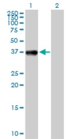 Anti-CIAPIN1 antibody produced in rabbit