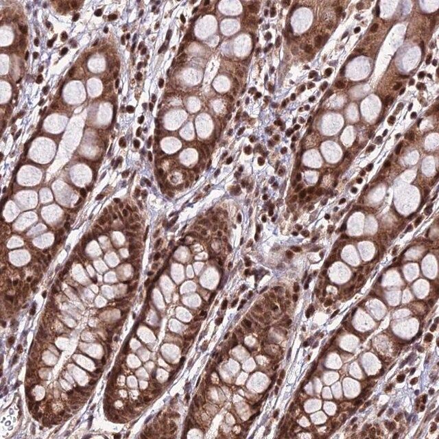 Anti-CIB3 antibody produced in rabbit