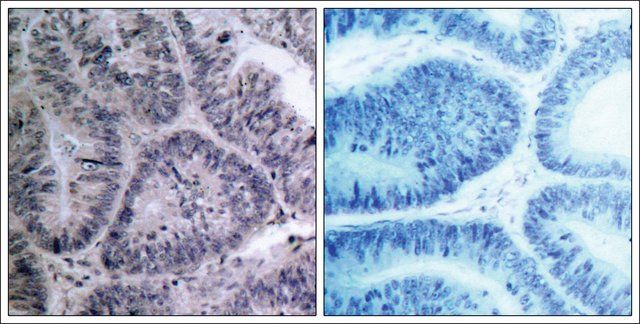 Anti-CHUK (Ab-23) antibody produced in rabbit