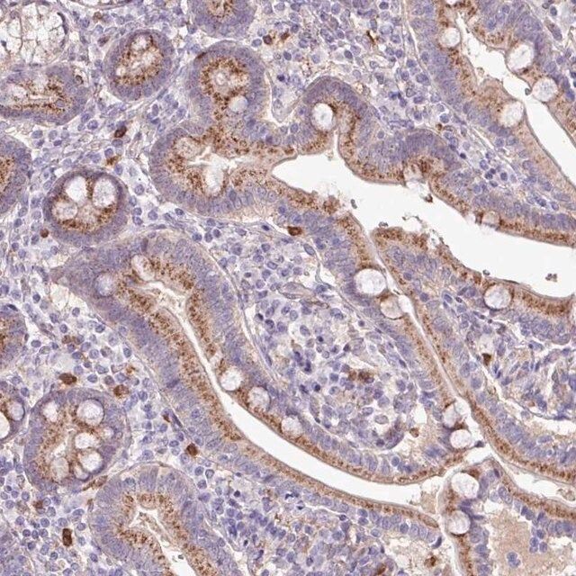 Anti-CHST11 antibody produced in rabbit