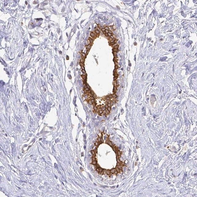 Anti-CIB1 antibody produced in rabbit