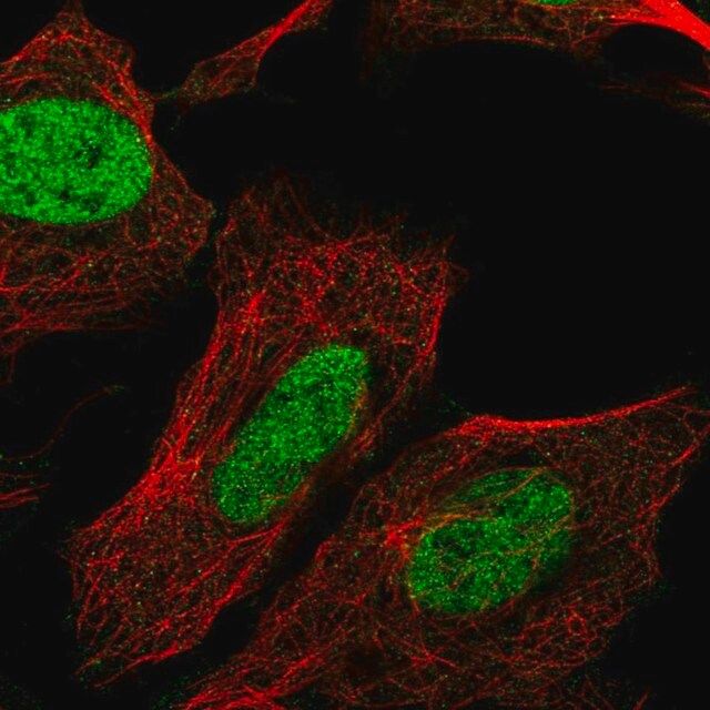 Anti-CHTF8 antibody produced in rabbit