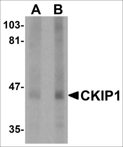 Anti-CKIP1 antibody produced in rabbit