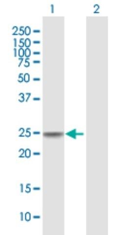 Anti-CIDEC antibody produced in mouse