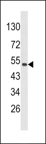 ANTI-CKIP-1(N-TERMINAL) antibody produced in rabbit