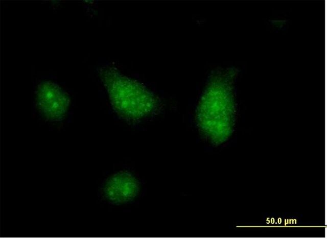 Anti-CISH antibody produced in mouse